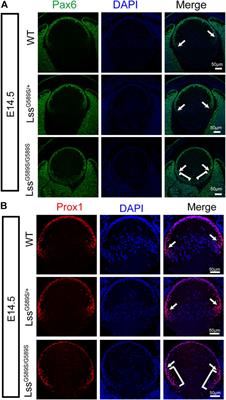 Defect of LSS Disrupts Lens Development in Cataractogenesis